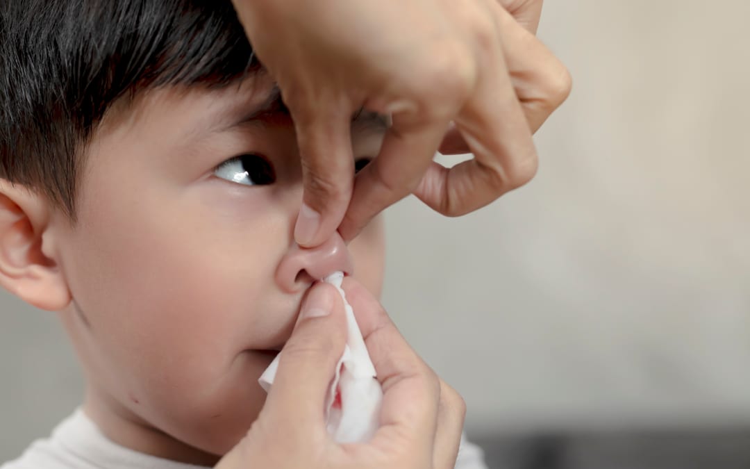 A Parent’s Guide to Understanding and Managing Nosebleeds